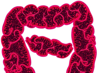 Epigenetic Split in AKAP12-LMOD1 Axis Shapes Colorectal Cancer Stroma and Epithelium