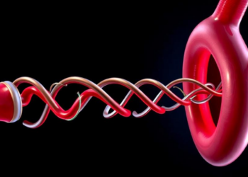 LVIS Stent Shows Strong Occlusion Rates but Real Risks in Wide-Necked Aneurysms