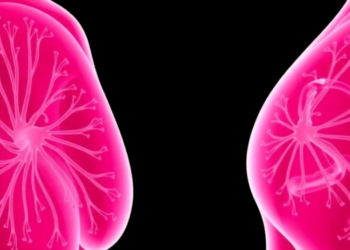 Root Canal Bacteria and Breast Cancer: New Meta-Analysis Finds No Clear Link, But Clues to Tumor Progression