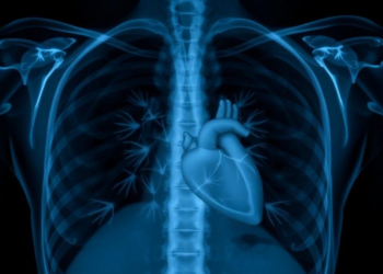 AI Reads Chest X-rays to Spot Early Heart Dysfunction in Obesity and Diabetes