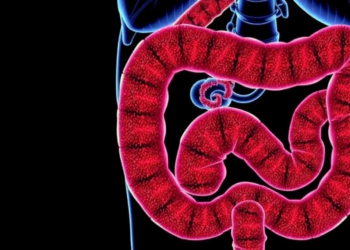 Macrophage TRPV1 Loss Worsens Diet-Driven Colitis and Gut Fibrosis in Mice