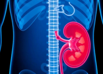 New L.E.N.S.O. Score Predicts Success of Laser Surgery for Kidney Diverticulum Stones
