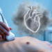 Every echocardiogram number hides a cloud of uncertainty, commentary warns