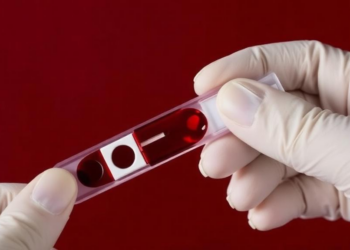 Simple Blood Test Could Reveal When Sepsis Kills, Even After Death