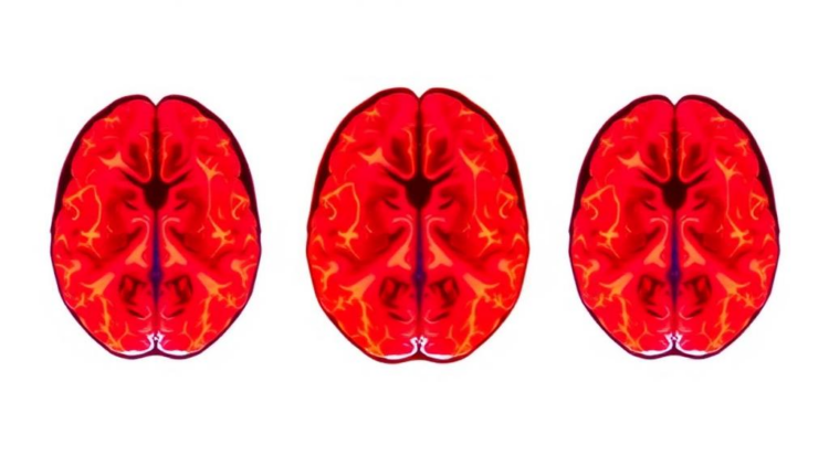 Brain Network Scans Reveal Depression Looks Different in Teenagers and Adults