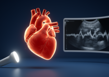 Hyperdynamic heart function in ICU patients does not mirror longitudinal strain measures