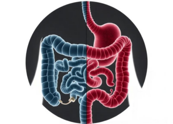 Two Gut Microbe Types Split IBD Patients Into Very Different Diseases