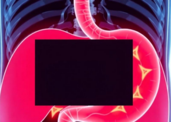 AI Scoring of Stomach Lining Visibility Boosts Early Cancer Detection in Landmark Trial