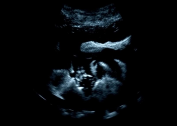 Two new US patents widen Ultrasound AI’s reach from pregnancy imaging to drug detection