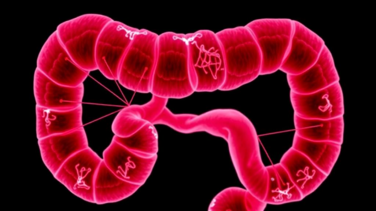 Misplaced Gap Junction Protein Drives Colorectal Cancer Spread—and Reveals a Drug Weakness
