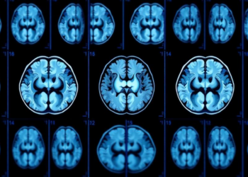 AI Reads Brain Scan Sequences to Spot Alzheimer’s With New Hybrid Model