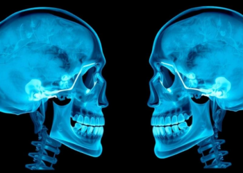 AI Framework Aligns Skull X-Rays With Facial Photos for Orthodontics