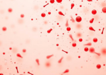 Normal Labs Last Week, Purulent Bile Today: How Severity Rules Decide Cholangitis Care