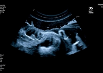 Rethinking Ultrasound After a Child’s First Urinary Tract Infection: Radiologists Answer Their Critics