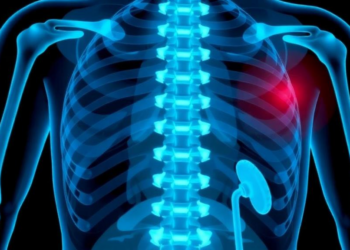 Bone Metastases Drive Rapid Muscle Wasting and Poorer Survival in Kidney Cancer