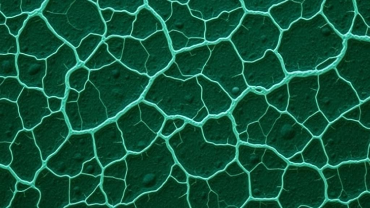 Plant Flavonoid Sophoraflavanone G Cracks Staphylococcal Biofilms but Spares Pseudomonas