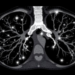Contrast-Enhanced Ultrasound Guides Lung Cancer Biopsies When Bronchoscopy Fails