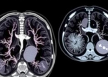 AI Reads Fetal MRI Lungs in Seconds, Transforming Prenatal Risk Assessment
