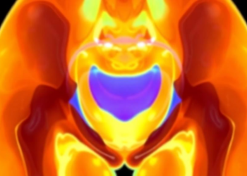 Dynamic MRI Reveals How the Young Pelvic Floor Moves From Rest to Strain to Squeeze