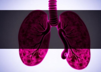 UCLA Team Wins $1 Million Award to Detect Lung Cancer Nodules Noninvasively