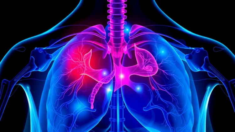 New Biomarkers and AI Aim to Cut Unnecessary Prostate Biopsies Before the Needle