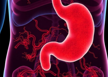Inflammation-Driven Spatial Niche Sets the Stage for Early Gastric Cancer