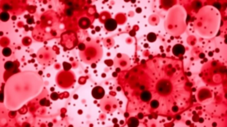 Amino Acid Fingerprint in Blood Reveals Who Escapes Fatty Liver Disease