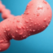 Gut Microbes Emerge as Unexpected Players in the Fight Against Eczema