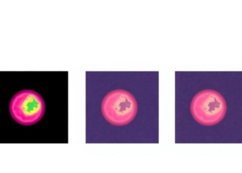 Three AI Models, One Verdict: Ensemble Network Pushes Skin Cancer Detection Toward 99% Accuracy