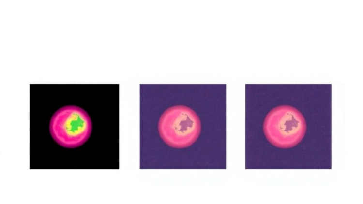 Three AI Models, One Verdict: Ensemble Network Pushes Skin Cancer Detection Toward 99% Accuracy