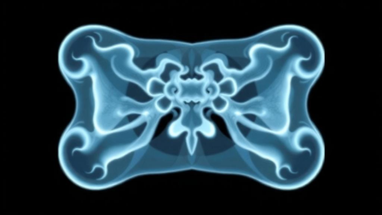 AI Models Predict Bone Scan Outcomes Before Imaging, but Time May Erode Their Accuracy