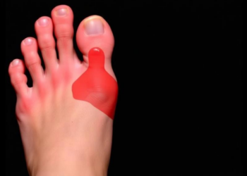AI Can Spot Diabetic Foot Ulcers, But Most Studies May Be Overstating How Well It Works