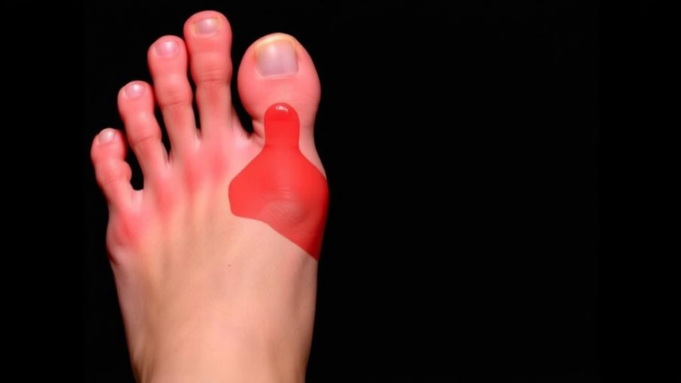 AI Can Spot Diabetic Foot Ulcers, But Most Studies May Be Overstating How Well It Works