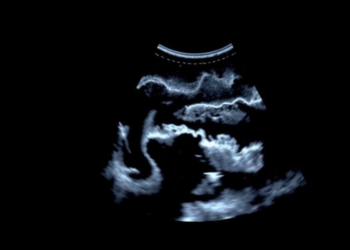 Ultrasound Offers an Objective Window Into Morphea Treatment Response