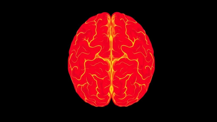 Childhood Cancer Survivors Face Fivefold Higher Risk of Later Brain Tumors, Population Study Finds