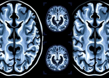 Brain Scans Reveal When Alzheimer’s Damage First Appears in Younger Patients