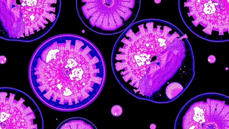 AI Reads Biopsy Slides to Predict Stomach Cancer Spread Before Surgery