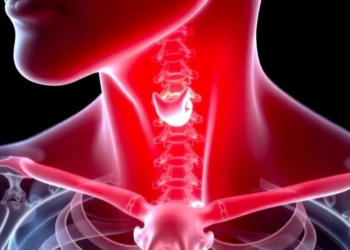 Hidden Cancers in Overactive Thyroids: Study Finds One in Three Graves’ Patients Harbored Tumors