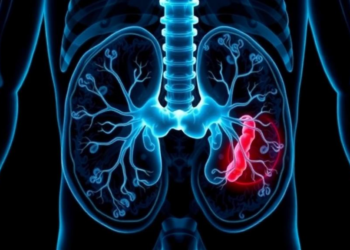 FGFR3 Protein Overexpression Predicts Bladder Cancer Recurrence, Study Finds