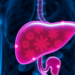 Blocking Fructose Metabolism Shows Promise Against Fatty Liver Disease