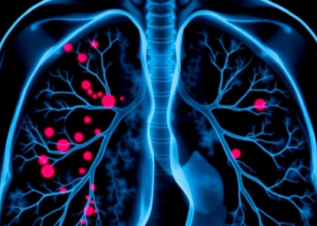 Data-Efficient AI Transformer Hits Near-Perfect Accuracy in Lung Cancer Diagnosis
