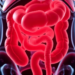 AI and Multi-Omics Could Predict Necrotizing Enterocolitis Before Symptoms Strike