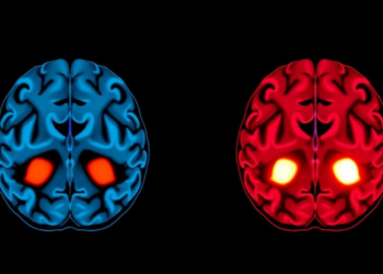Mindfulness Is Not One Skill: Brain Scans Reveal Opposing Signatures of Presence and Acceptance