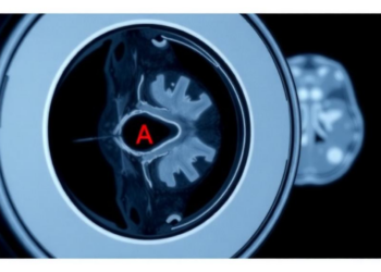 MRI Technique Reads Tumor Chemistry to Sort Risky Childhood Cancers Before Surgery