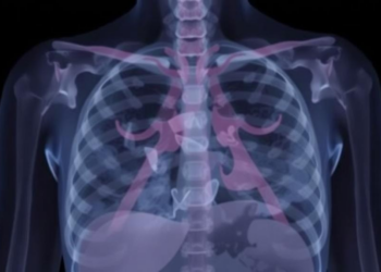 Colombian Study Tracks Ten-Year Survival in Breast Cancer Patients Carrying Inherited Risk Variants