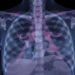 Colombian Study Tracks Ten-Year Survival in Breast Cancer Patients Carrying Inherited Risk Variants