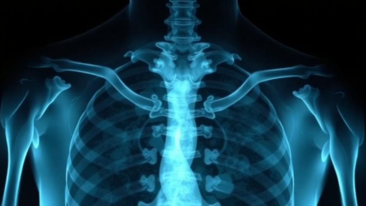 Wavelets Meet Mamba: AI Reads Shoulder X-rays to Spot Rotator Cuff Tears