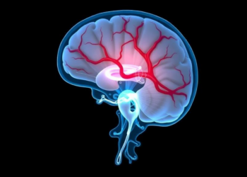 Hidden Veins in the Skull Could Transform How Surgeons Treat Hydrocephalus