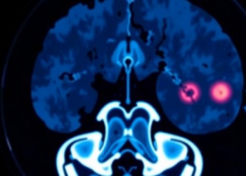 New PET Scan Model Could Tell Dangerous Childhood Tumors From Benign Ones Without Surgery