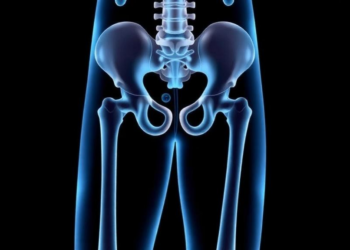 Routine Blood Test Marker RDW Linked to Higher Hip Fracture Risk in Older Adults